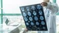 El reloj biológico de la mente: Descubren cómo cada trastorno mental acelera el envejecimiento cerebral de forma única