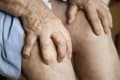 ¿Dolor de manos? La conexión inesperada entre la microbiota oral y la artritis en los dedos