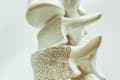 Identifican cómo la periodontitis puede agravar la osteoporosis a través de la microbiota intestinal